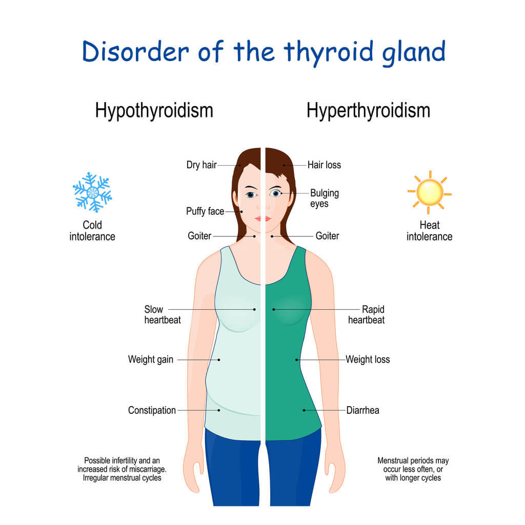 Lose Weight with Low Thyroid | Functional Medicine Tips, Tests ...