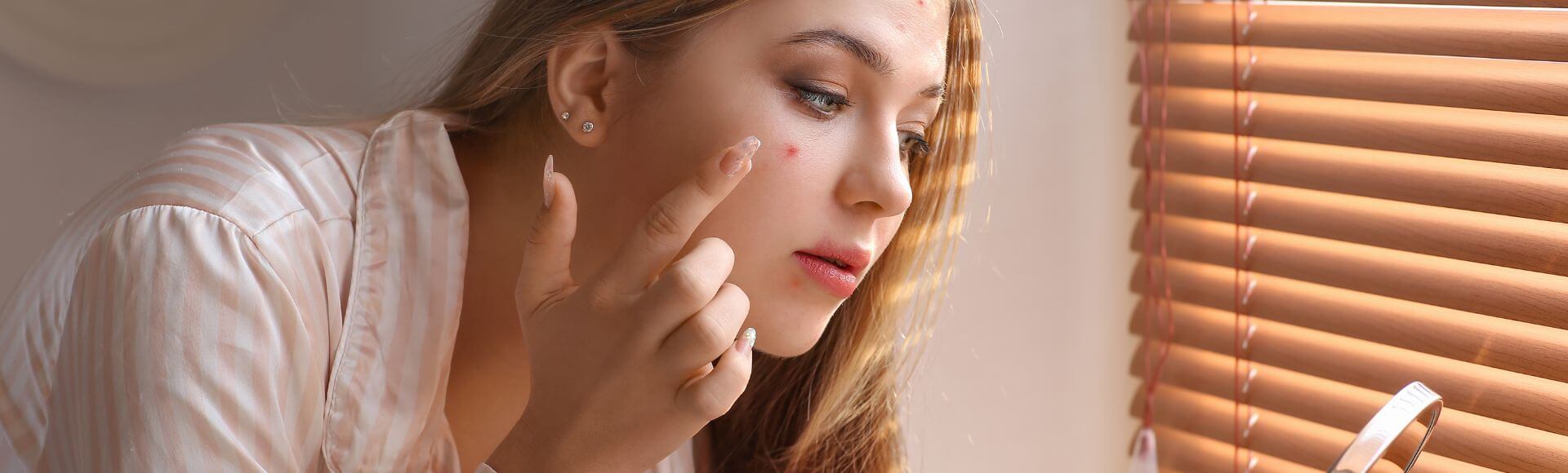 Chinese medicine for acne