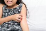 functional medicine treatment and management for eczema in children