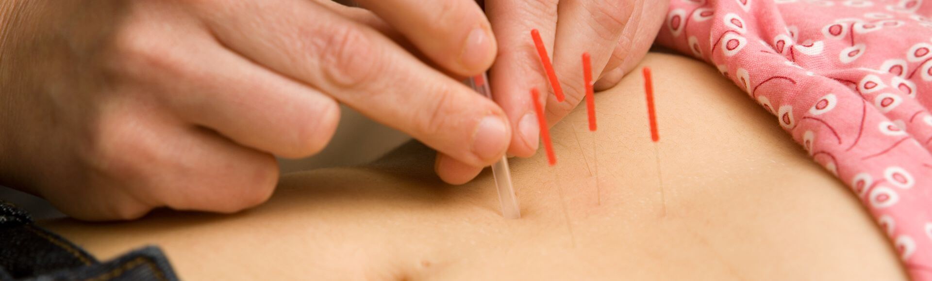 fertility acupuncture near me