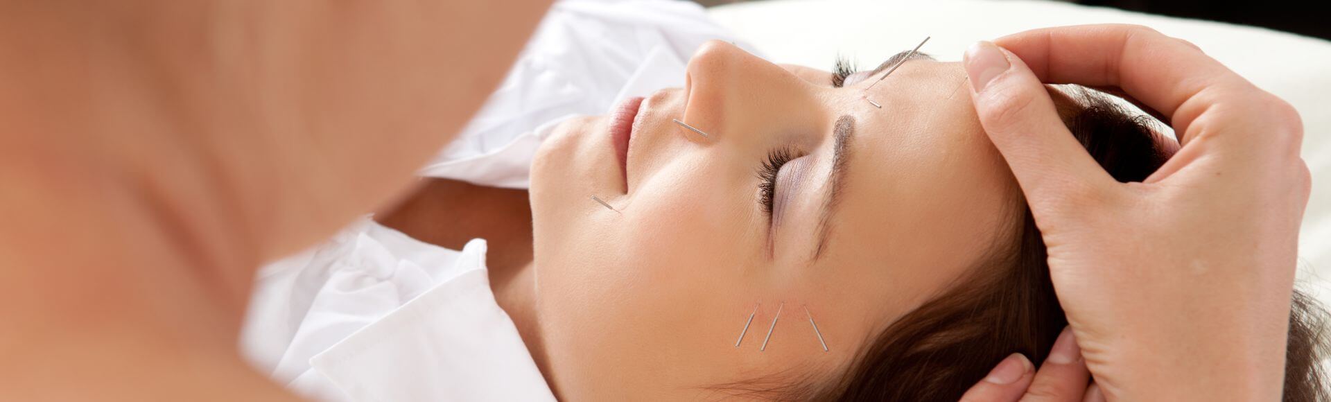 Benefits of Facial Acupuncture