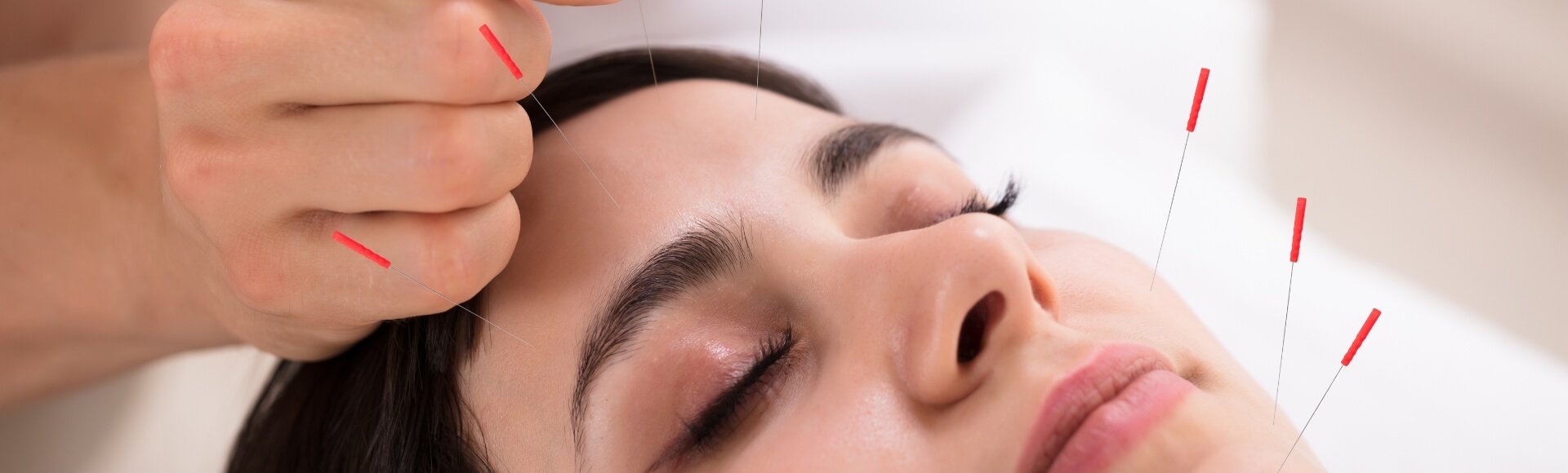 acupuncture facial atlanta