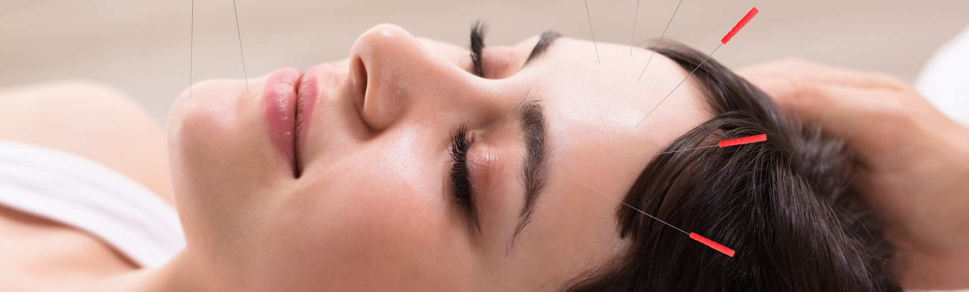acupuncture facial brookhaven