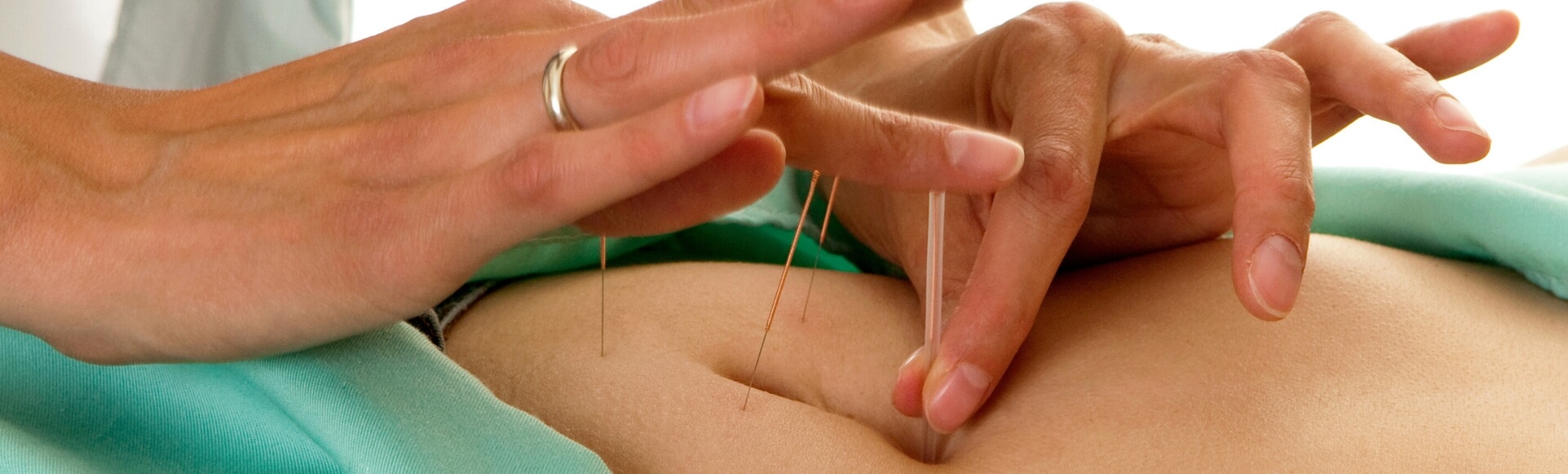 endometriosis acupuncture near me