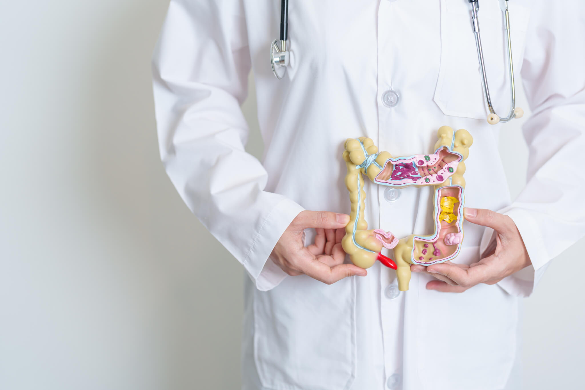 importance of colon screening